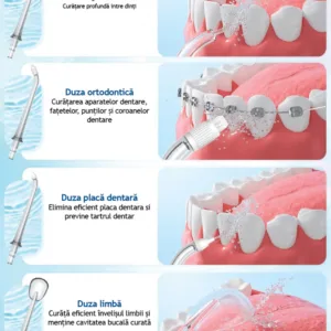Set 4 duze interschimbabile pentru irigator bucal